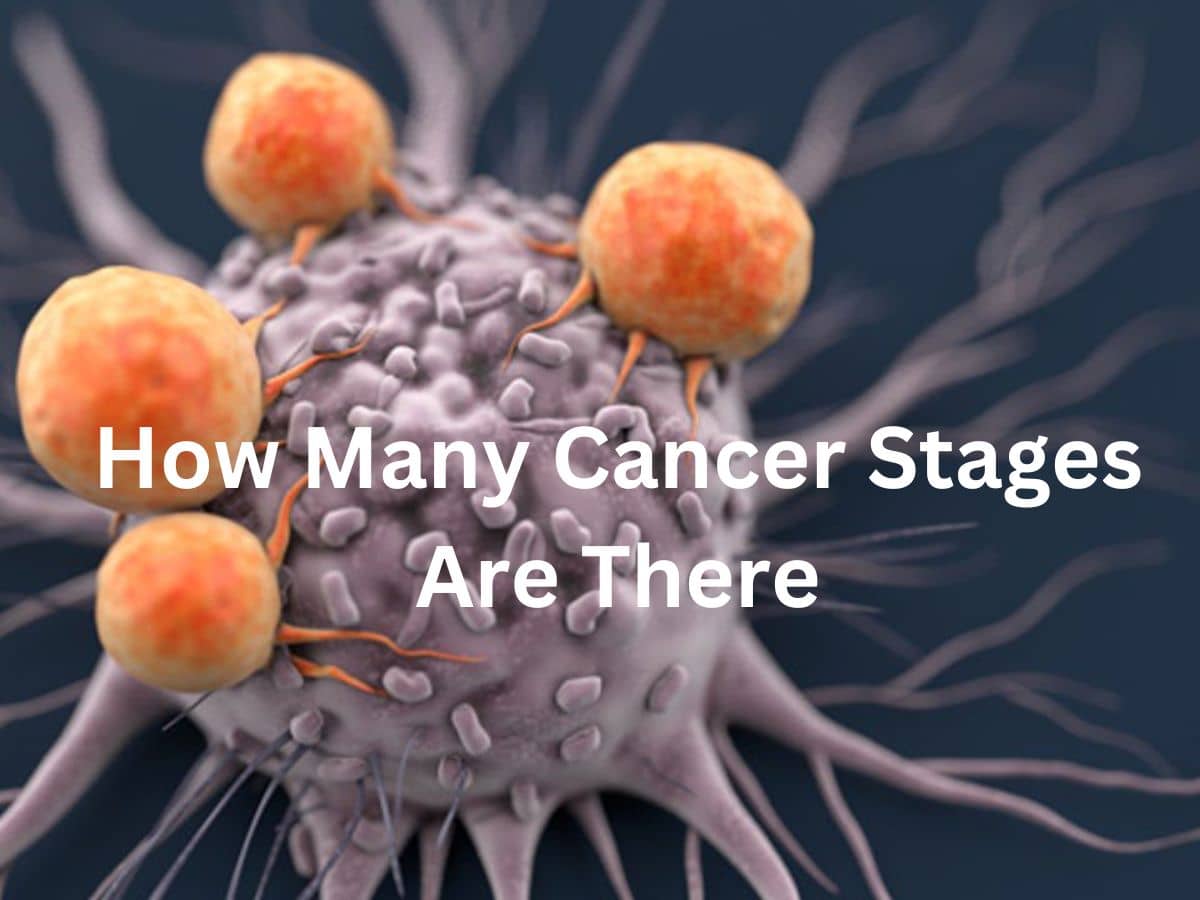 Stages of cancer